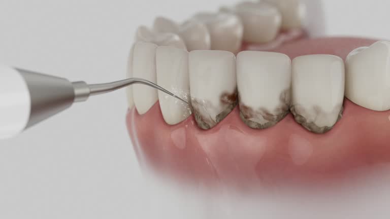 Reliable Dental contractor in Converse, IN by Dentist Open Now